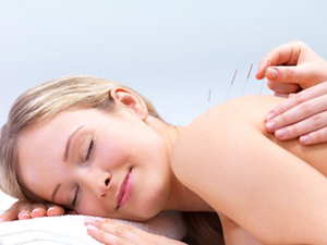 Acupuncture Acupuncture